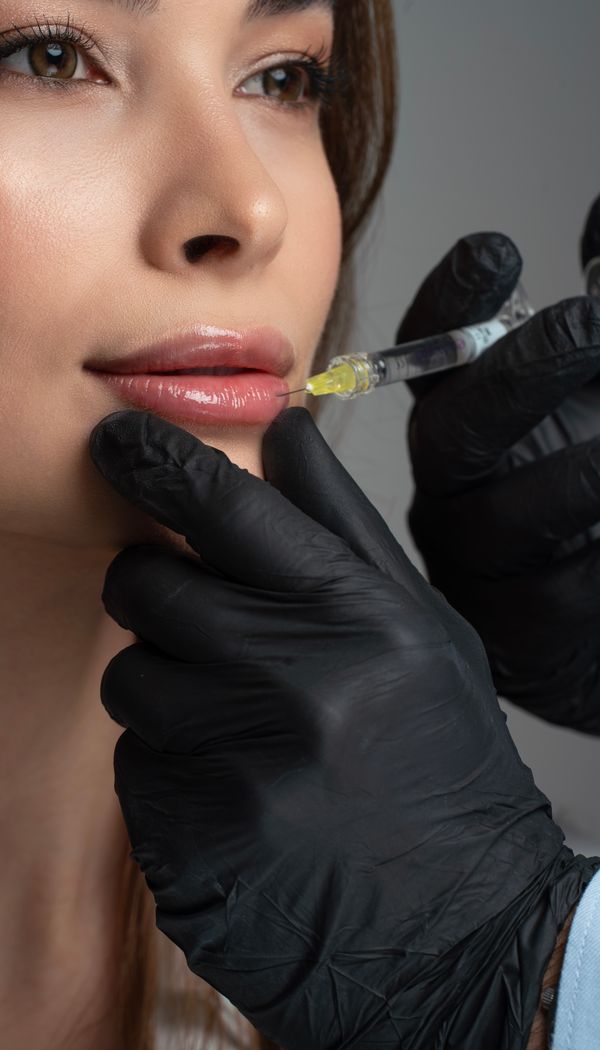 Lip filler injection at Skin Lab Aesthetics Lahore