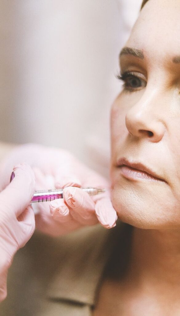 Hyaluronic acid dermal filler injection by an aesthetic practitioner
